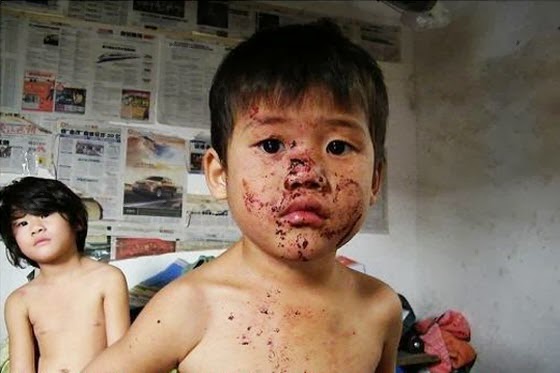 child-abuse-ningbo-china